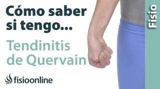 Cómo saber si tienes TENDINITIS de QUERVAIN o tendinitis del pulgar