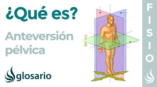 ANTEVERSIÓN | Qué es, causas, qué estructuras están involucradas y a quién afecta