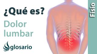 DOLOR LUMBAR | ¿Qué es?