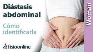 Cómo IDENTIFICAR si tengo DIÁSTASIS ABDOMINAL