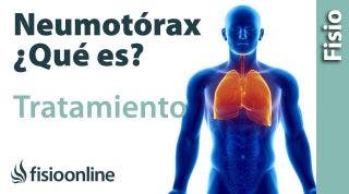 Neumotórax  Qué es, consejos y tratamiento a través de la fisioterapia respiratoria