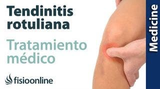 ¿Tienes una Tendinitis del rotuliano? Claves para entender su tratamiento