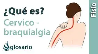CERVICOBRAQUIALGIA | ¿Qué es?