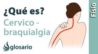 CERVICOBRAQUIALGIA | ¿Qué es?