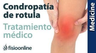 Cómo puedes aliviar tu dolor cuando tienes Condropatía de rótula