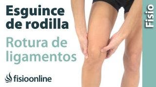 1 Cómo saber si hay un esguince de rodilla o rotura de ligamentos de rodilla