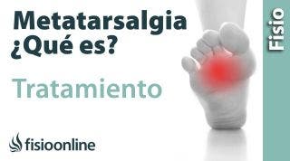 Metatalsargia. Tratamiento mediante ejercicios, auto masajes y estiramientos