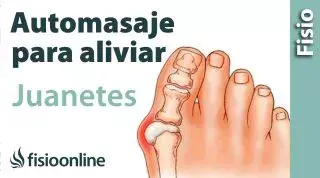 23.Auto-masaje para el hallux valgus o “juanete".