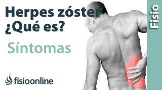 HERPES ZÓSTER | Qué es, qué estructuras afecta, síntomas, signos, causas y tratamiento