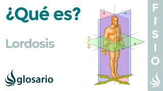 LORDOSIS | Qué es, por qué se produce, cuáles son sus síntomas y a quién afecta