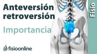 32# Anteversión y retroversión pélvicas. Que son y cual es su importancia.