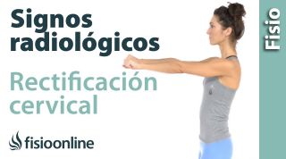 Rectificación cervical e inversión de arco cervical - Signos radiológicos.