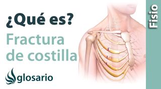 FRACTURA DE COSTILLA | ¿Qué es?