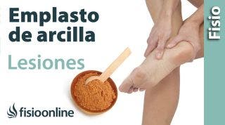 Emplasto de arcilla para esguinces, contusiones, inflamaciones y desgarros musculares.