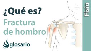 FRACTURA DE HOMBRO | ¿Qué es?