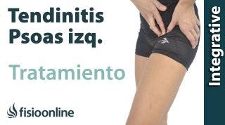 Tratamiento de la tendinitis del paso izquierdo o Psoitis izquierdo