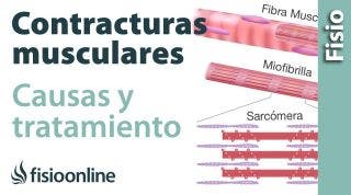 Contractura muscular - Qué es y cómo sucede