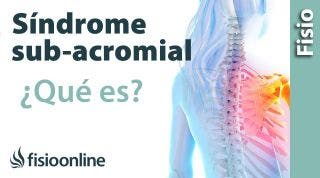 ¿Qué es el síndrome subacromial o síndrome de impactación?