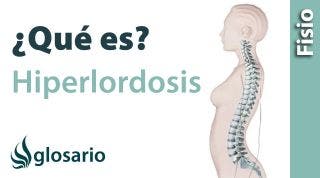 HIPERLORDOSIS | ¿Qué es?