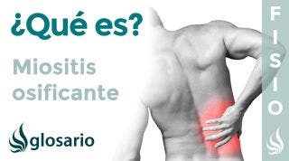 MIOSITIS OSIFICANTE | Qué es, qué afecta, síntomas, causas y tratamiento fisioterapéutico