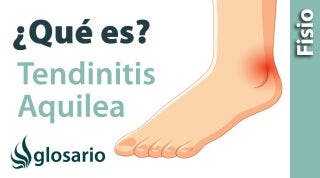 TENDINITIS AQUILEA | ¿Qué es?