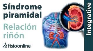 Síndrome del músculo piramidal izquierdo y su relación con el riñón