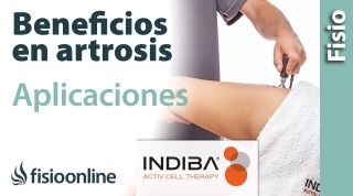 Beneficios y aplicaciones de INDIBA ACTIV para la artrosis