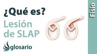 LESIÓN SLAP DEL HOMBRO | ¿Qué es?