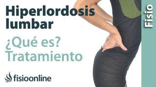 34# Lordosis e hiperlordosis. Qué es, causas, importancia y tratamiento.