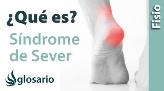 SÍNDROME DE SEVER | ¿Qué es?