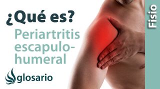 PERIARTRITIS ESCAPULOHUMERAL | ¿Qué es?