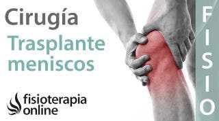 Trasplante meniscal: ¿Es necesario o se puede evitar?