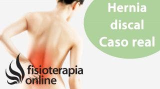 Hernia discal lumbar por una alteración ginecológica.Caso clínico real