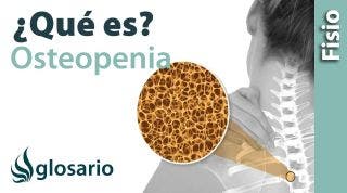 OSTEOPENIA | Qué es, qué afecta, síntomas, signos clínicos, causas y tratamiento fisioterapéutico