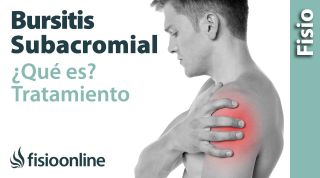 6# Bursitis subacromial en el hombro. Qué es, causas, síntomas y tratamiento.