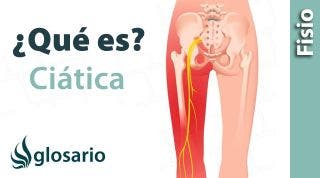 CIÁTICA O CIATALGIA | ¿Qué es?