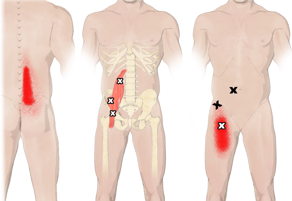 anatomía del músculo psoas