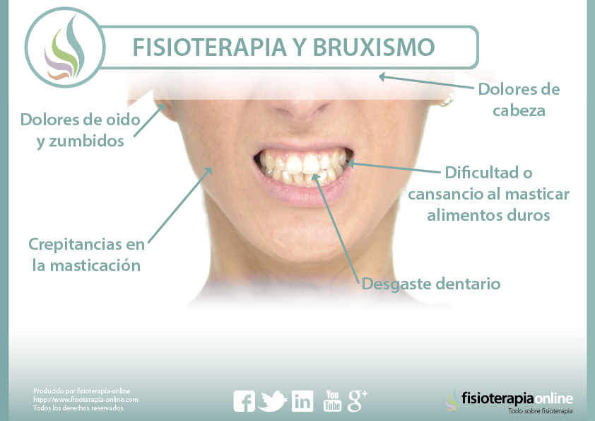 Fisioterapia y bruxismo