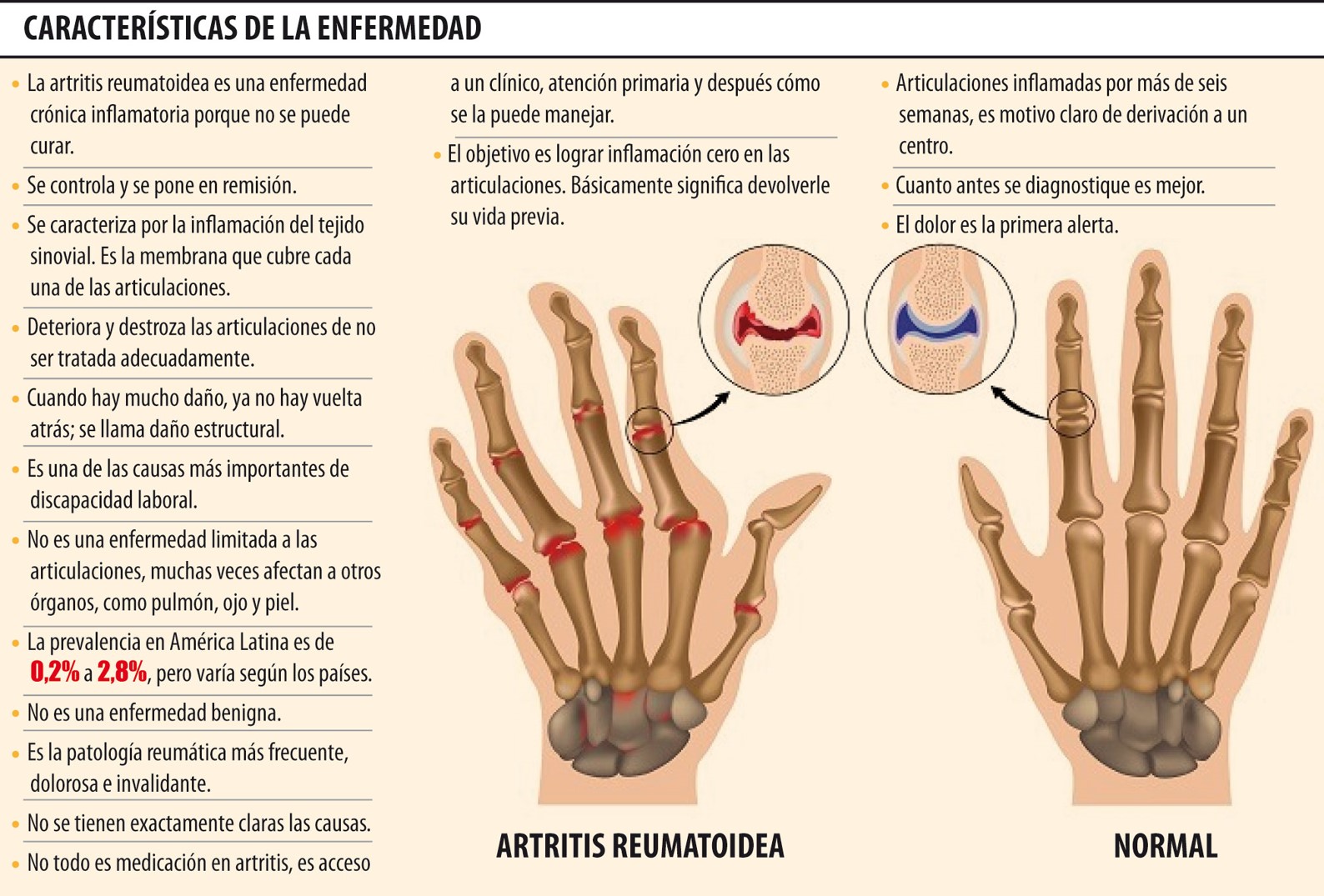 Características de la artritis reumatoide