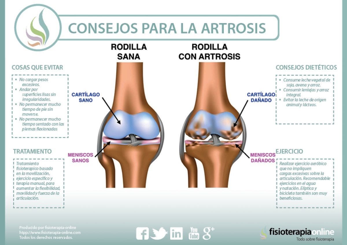 Consejos para la artrosis