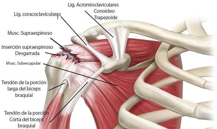 desgarro muscular en el brazo derecho desgarro muscular en el brazo derecho