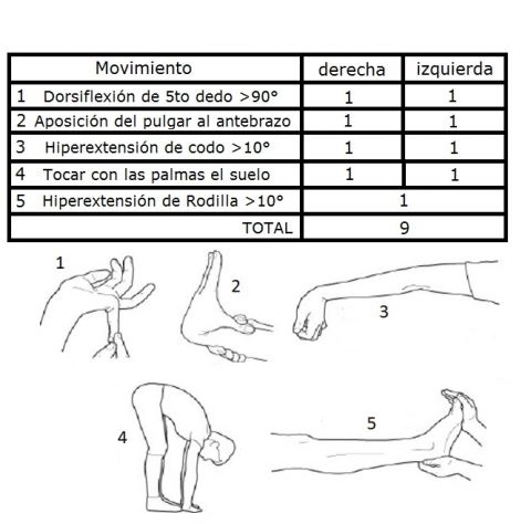 Hiperlaxitud Articular. Qué es, causas, síntomas y tratamiento