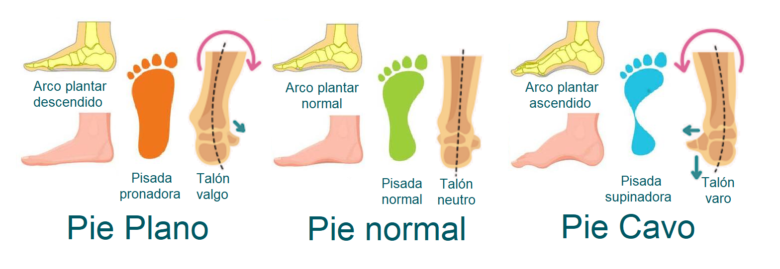 Pie plano