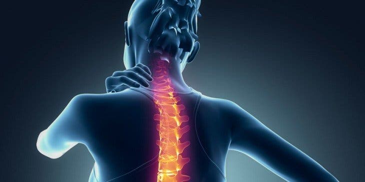 dolor cervical o cervicalgia