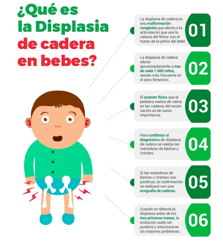 Displasia de cadera en bebés