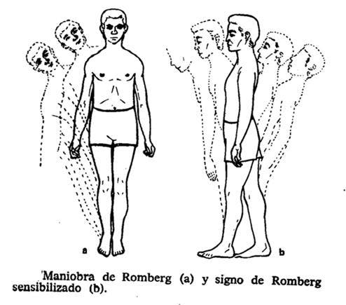 Pruebas de la ataxia