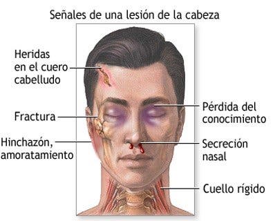 signos del traumatismo craneoencefálico