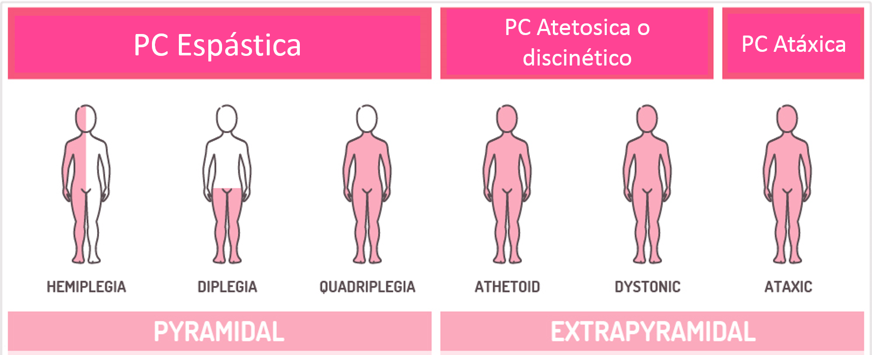 tipos de parálisis cerebral infantil